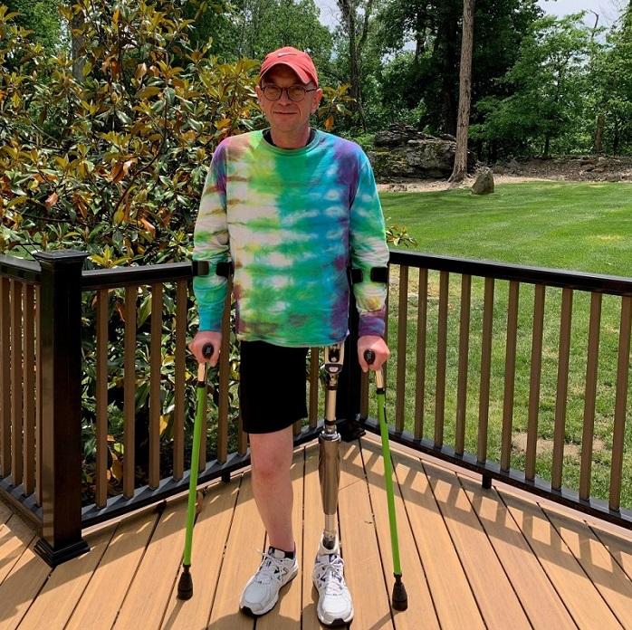 A man stands on an outdoor deck wearing an orange cap, glasses, a tie-dye long sleeved t-shirt, and black shorts with white sneakers. He has a prosthetic left leg up to the hip and green mobility aids in his hands.