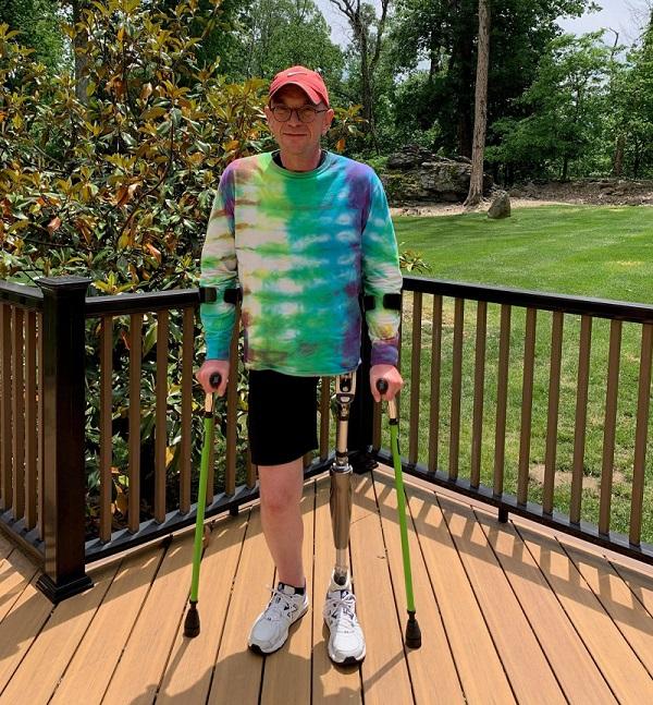 Help Hope Live client Kristoffer Kristensen wears a tie dye shirt and a baseball cap with black rimmed glasses and white sneakers. He has a prosthetic leg from the hip down on his left side and green crutches.