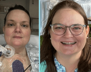 Two photos of heart transplant recipient Linda Jara. In one she is in the hospital. In the other she is smiling at an outdoor event. She has light skin, brown hair, and blue-gray eyes.